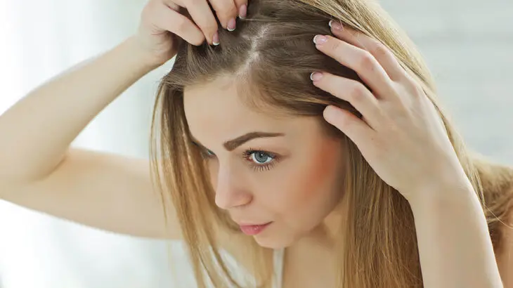 علاج تساقط الشعر بأسهل طريقة حديثة من المنزل